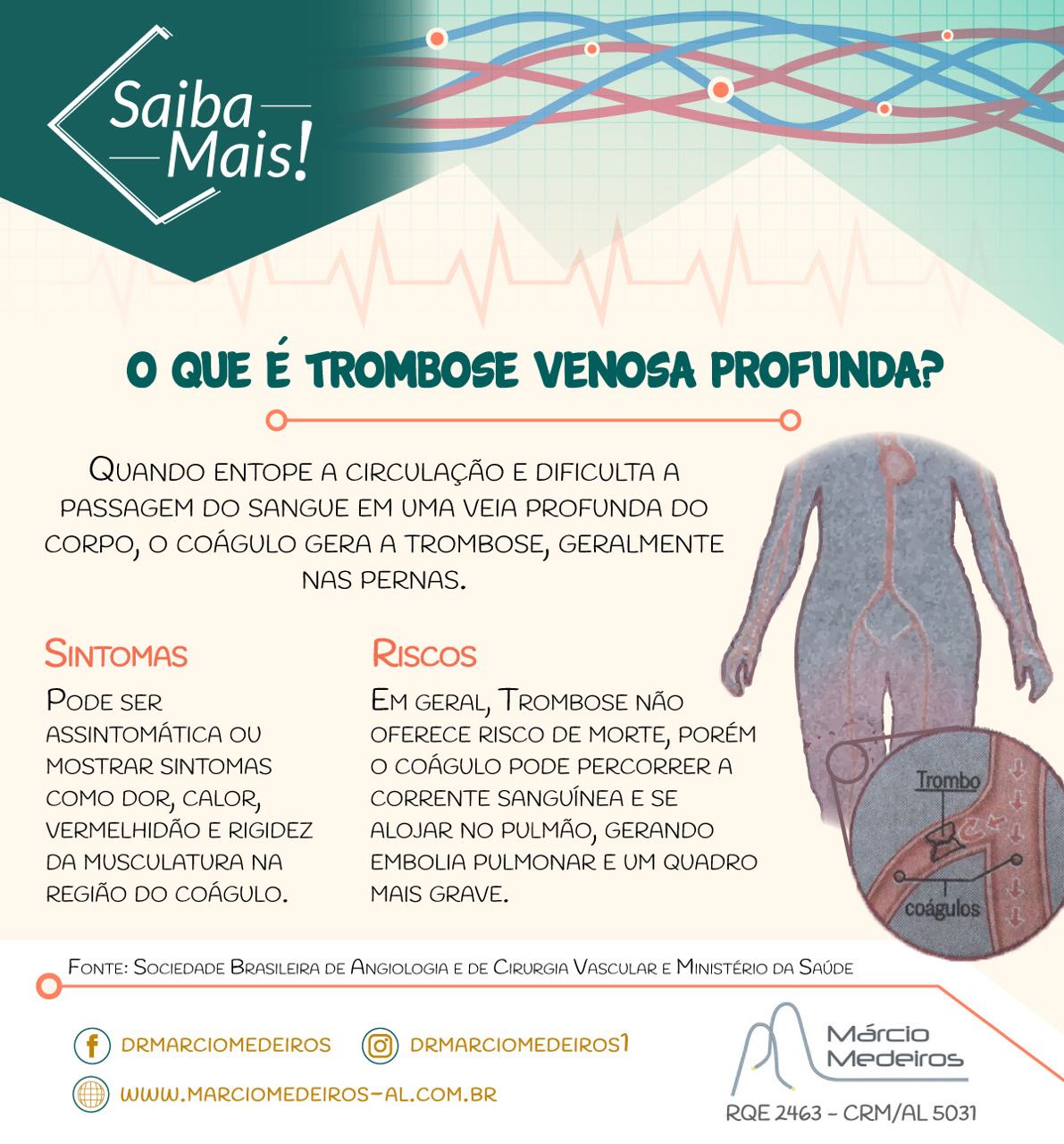 trombose venosa profunda o que é dr márcio medeiros