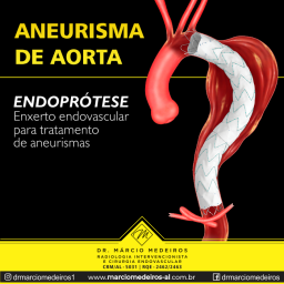 Endoprótese para o tratamento de aneurisma de aorta
